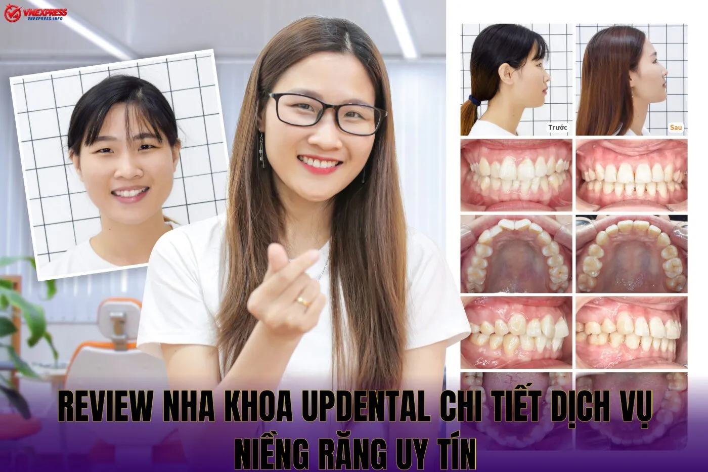 Review Nha Khoa UpDental Chi Tiết Dịch Vụ Niềng Răng Uy Tín